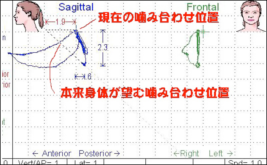千葉県千葉市の歯医者・歯科医・噛み合わせ
