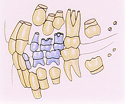 歯科矯正の加藤歯科